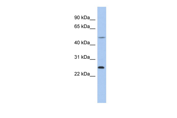 ctrb1 antibody - n-terminal region (arp33838_p050) in human thp-1 using western blot